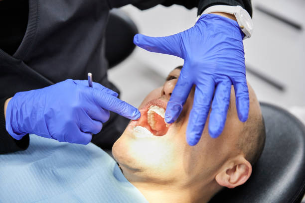 Best Emergency Root Canal Treatment in Summit View, WA